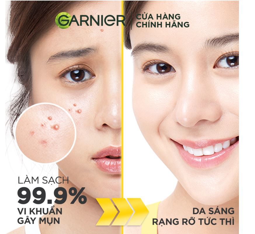 Sữa Rửa Mặt 3 Trong 1 Giảm Mụn & Sáng Da Garnier Bright Complete 3 In 1 Foam Anti Acne 90ml