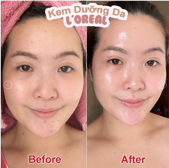 Kem Dưỡng Da Mờ Thâm Nám Ban Đêm L'Oreal Glycolic Bright Glowing Cream Night 50ml