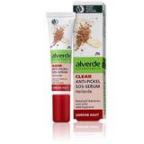 Serum làm trắng da và ngăn ngừa mụn Alverde