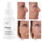 Serum cấp ẩm The Ordinary Hyaluronic Acid 2% + B5