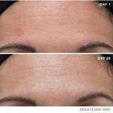 Miếng Peel trị lão hoá Dr Dennis Gross Ferulic + Retinol wrinkle