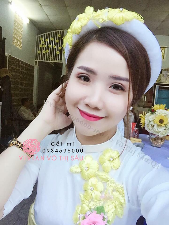 Cắt Mí Hàn Quốc