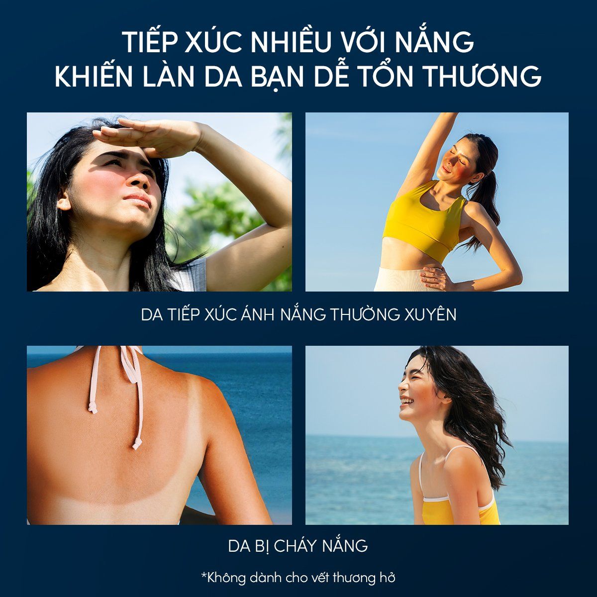 C26: DEAL 32 BACK-UP: SERUM DƯỠNG DA VÀ PHỤC HỒI TỔN THƯƠNG DA SAU NẮNG ANESSA NIGHT SUN CARE SERUM 180ML