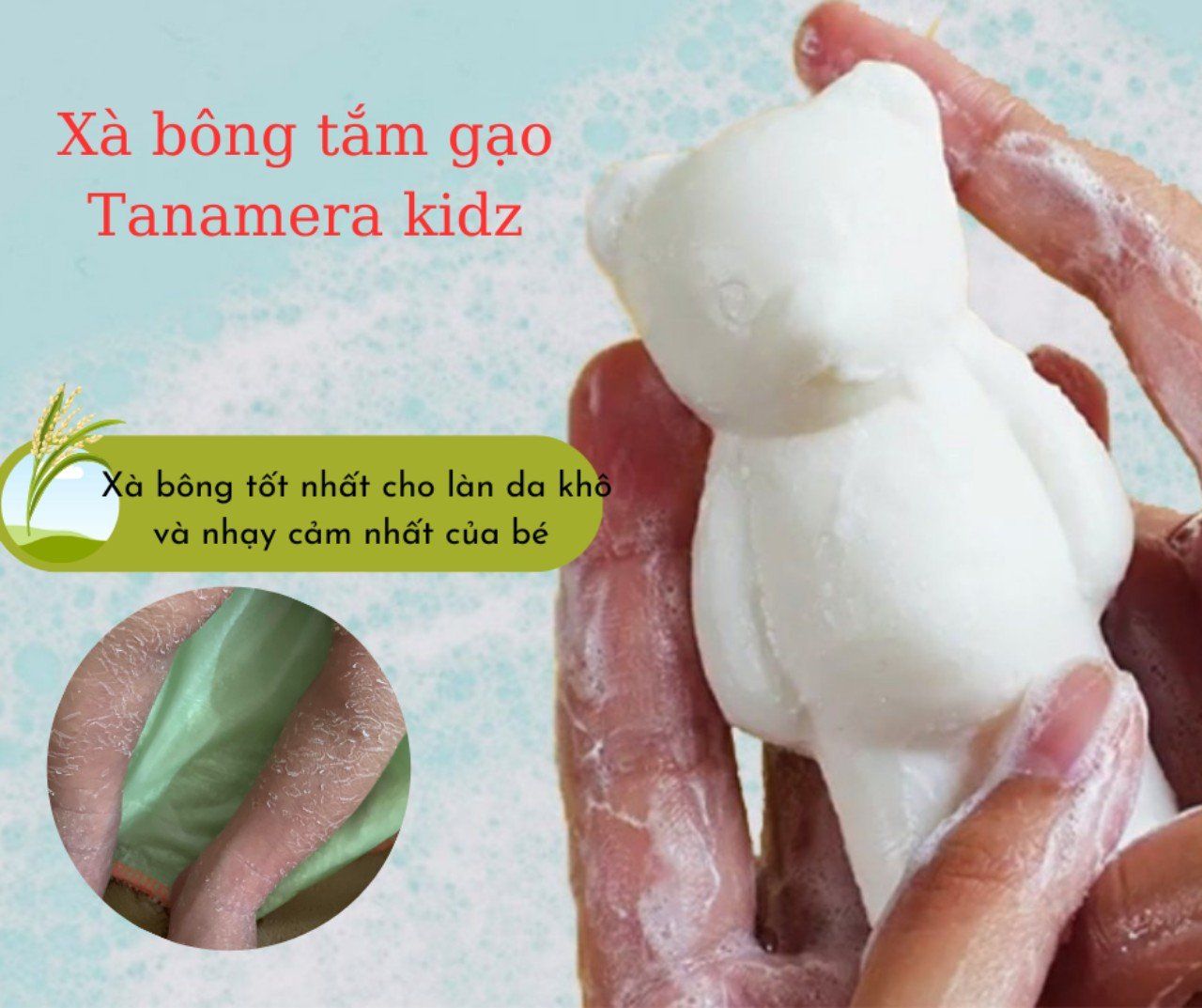 E.M Combo kem trị chàm sữa Bio Bio Baby