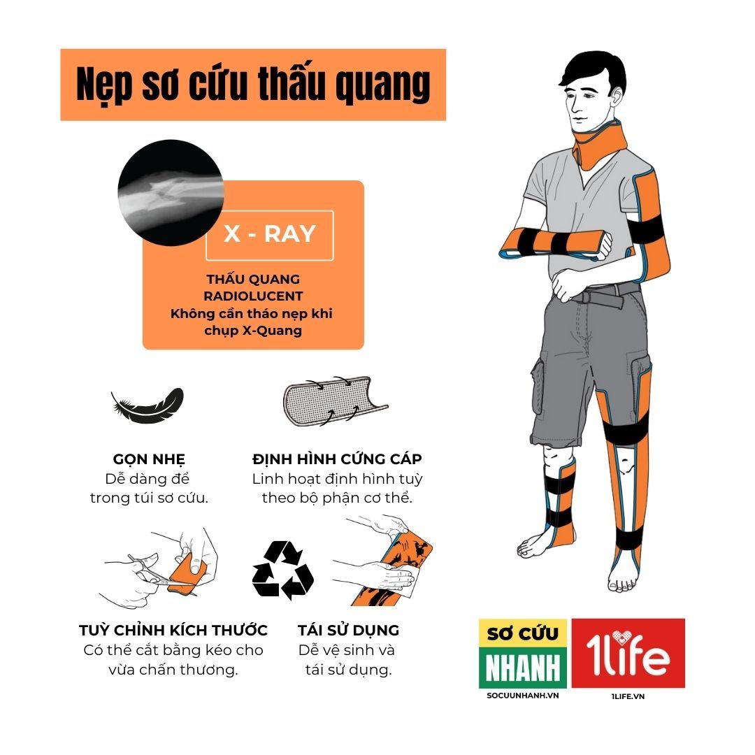 NẸP SƠ CỨU THẤU QUANG - RADIOLUCENT SPLINT - NẸP CAM, NẸP SAM