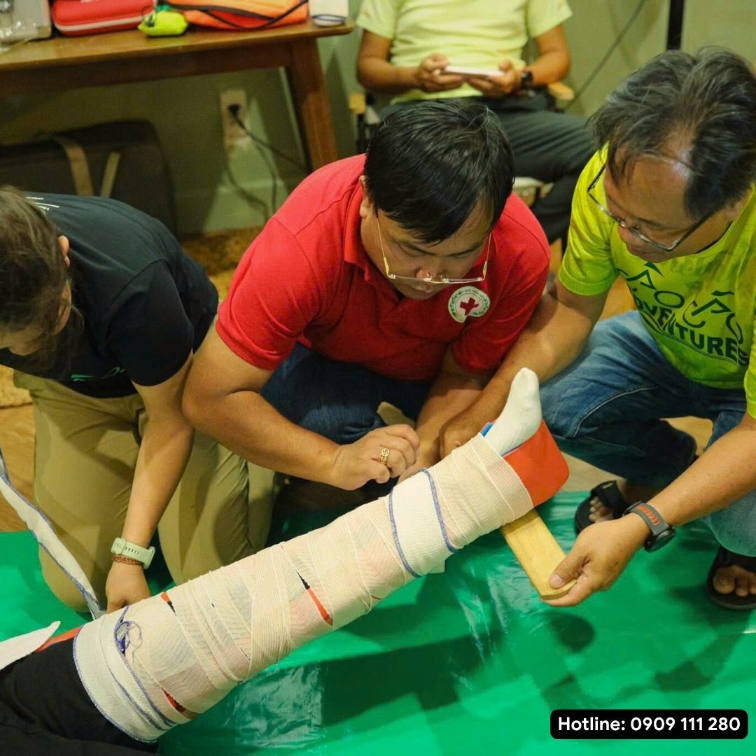 NẸP SƠ CỨU THẤU QUANG - RADIOLUCENT SPLINT - NẸP CAM, NẸP SAM
