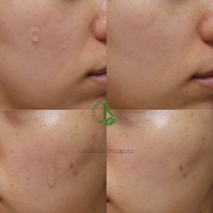 Tinh chất chống lão hóa, nâng cơ da Sur.medic+ Super Peptide 100 Collagen Lifting Serum 50ml