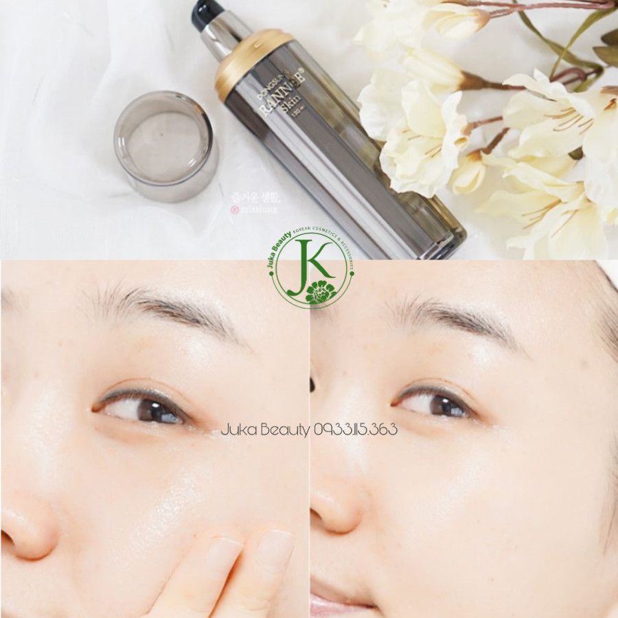 Set trị nám Dongsung Rannce Premium Skin Care 3 Set
