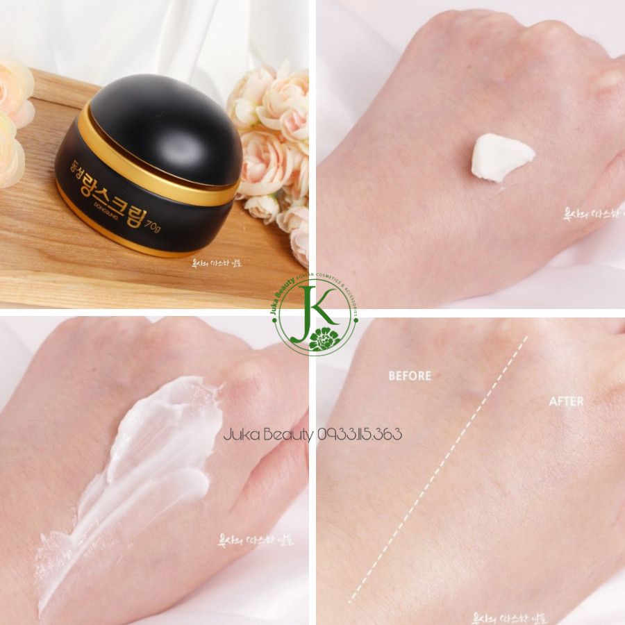Set trị nám Dongsung Rannce Premium Skin Care 3 Set