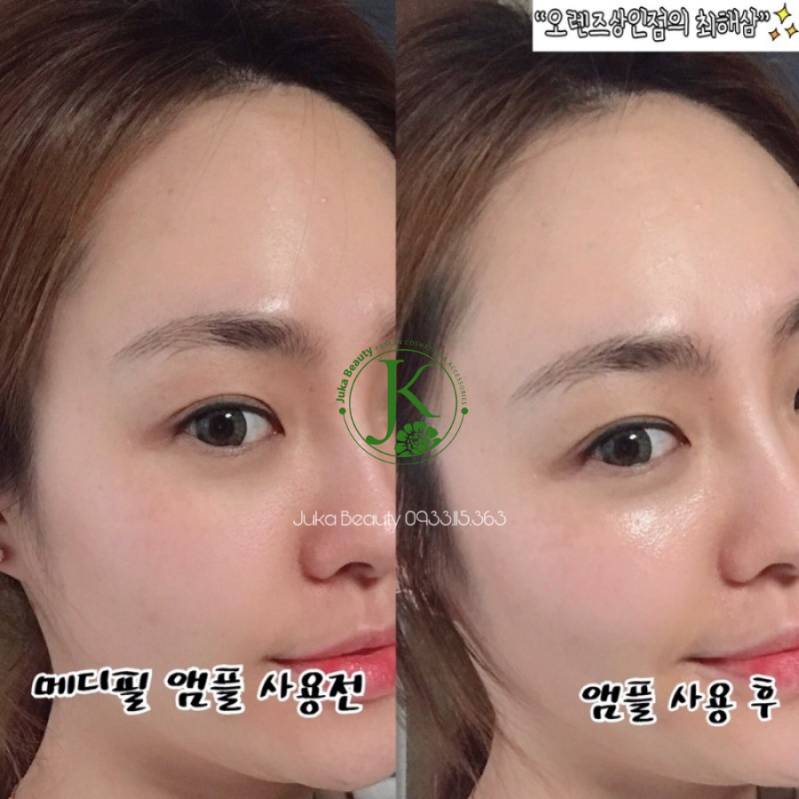 (Mẫu mới) Tinh Chất Dưỡng Trắng, Thu Nhỏ Chân Lông Medi-Peel Bio Intense Glutathione White Ampoule 30ml