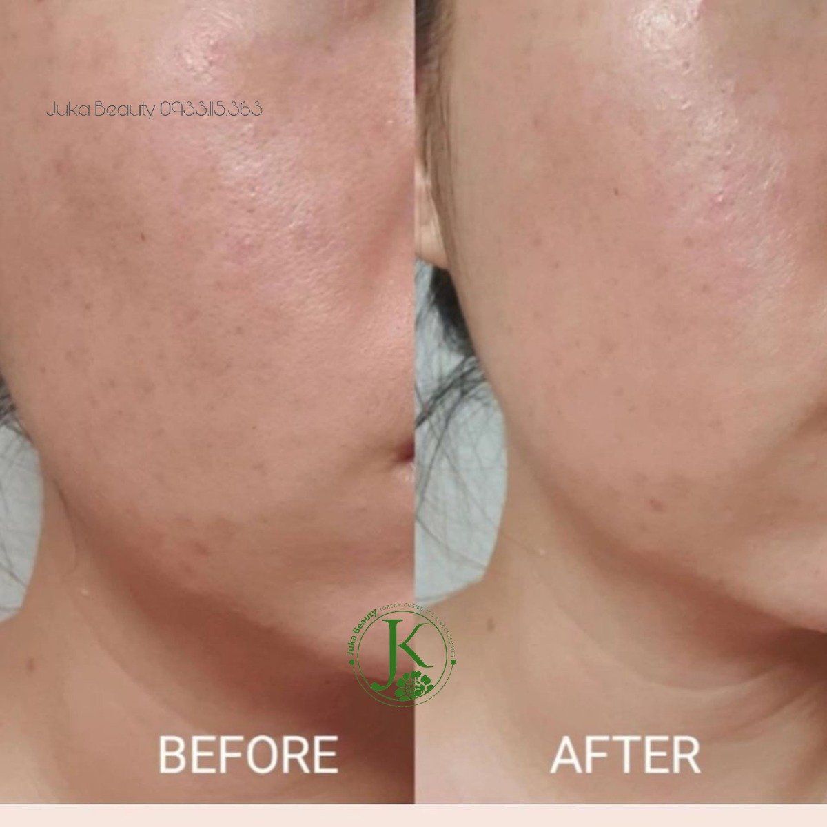 Tinh Chất Chiết Xuất Trà Xanh Isntree Green Tea Fresh Serum 50ml (DATE T3.2026)