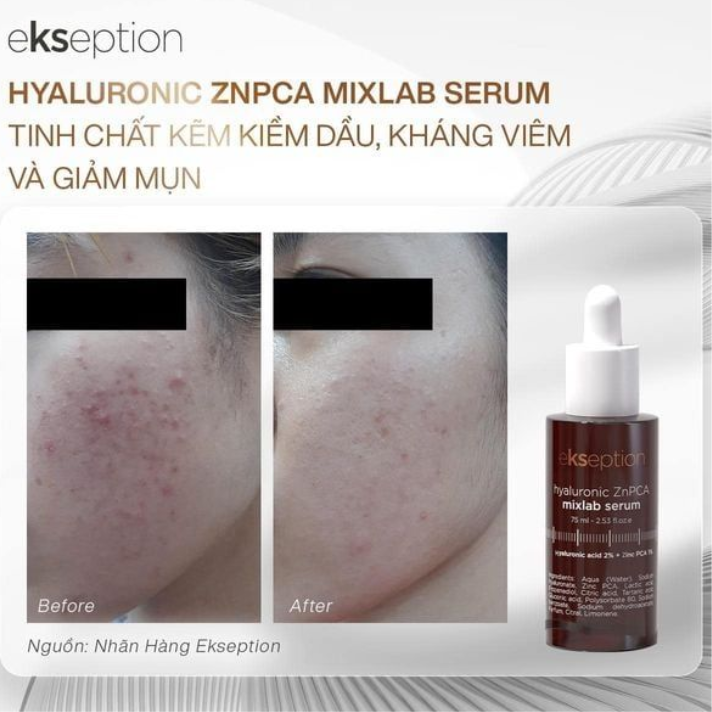 Tinh Chất Giảm Mụn, Kiềm Dầu Ekseption Hyaluronic ZNPCA Mixlab Serum 75ml