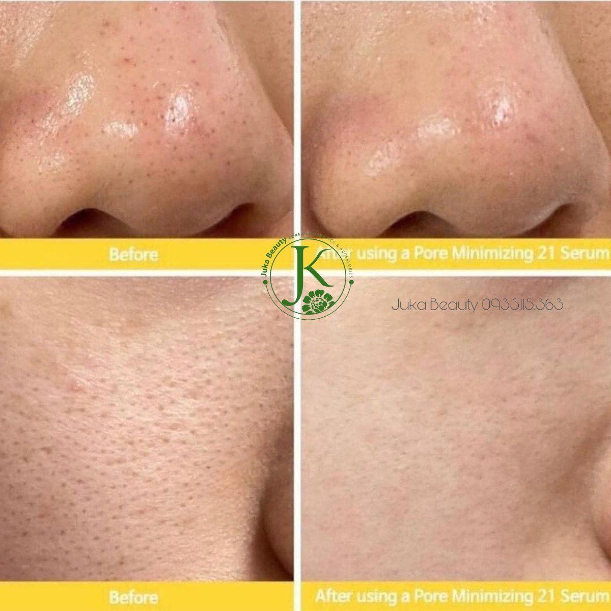 Tinh Chất Kiềm Dầu, Thu Nhỏ Lỗ Chân Lông Tiam Pore Minimizing 21 Serum 40ml
