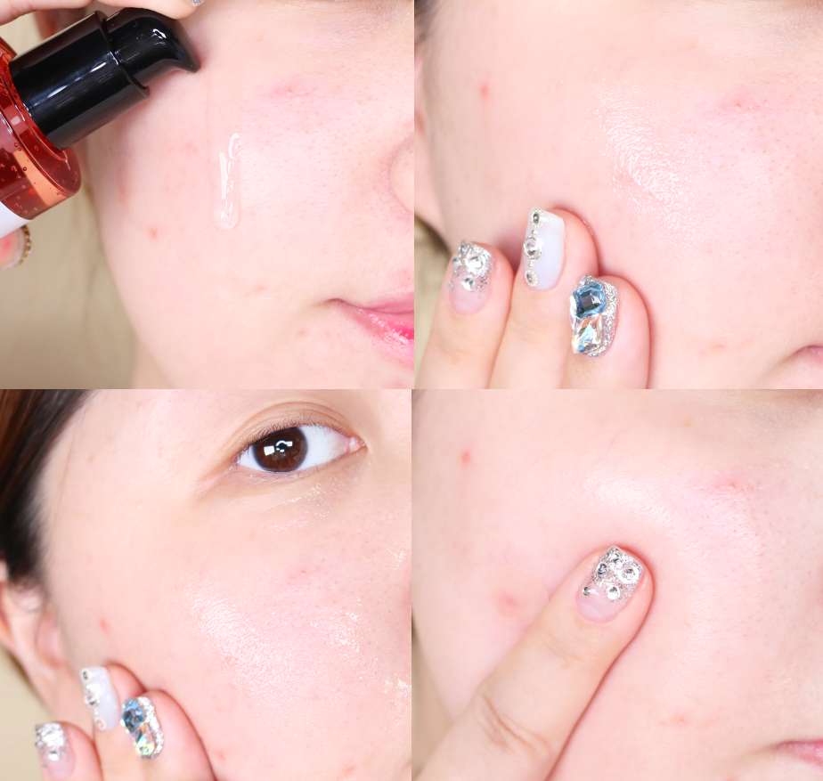 Bộ chăm sóc da làm mờ sẹo rỗ Some By Mi Snail Truecica Miracle Repair Starter Kit (4 Items)