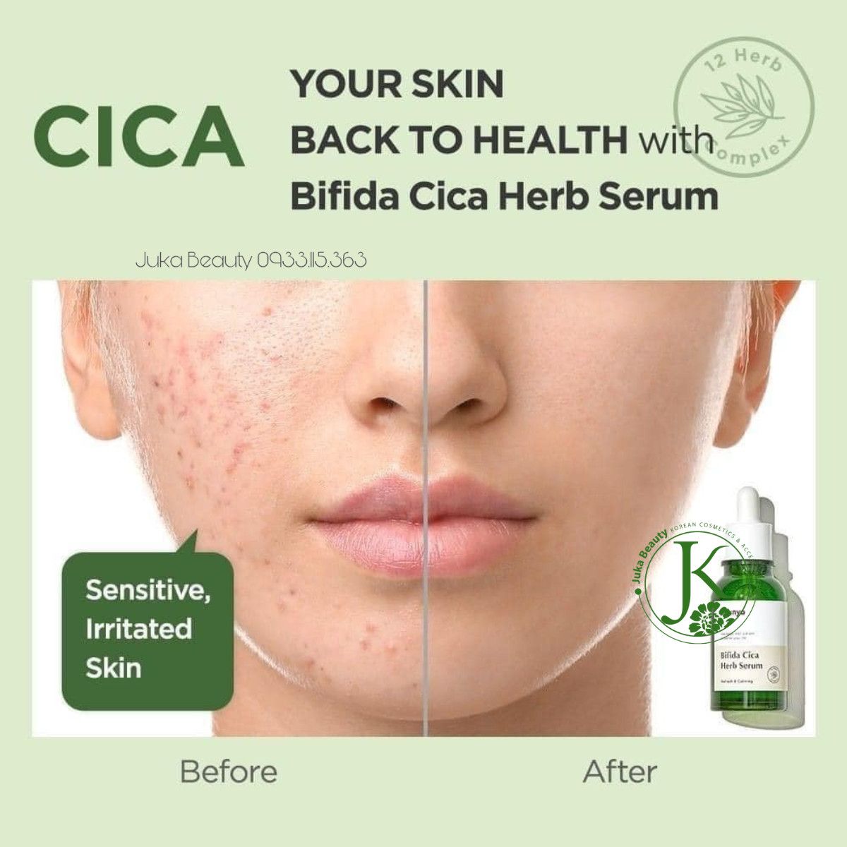 Tinh Chất Rau Má, Phục Hồi Da Manyo Bifida Cica Herb Serum 50ml
