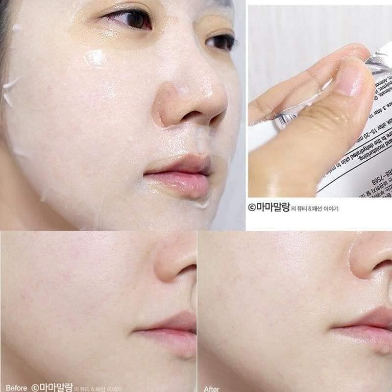 Mặt Nạ Thạch Dưỡng Da Vitamin BNBG Vita Genic Jelly Mask (1 miếng)