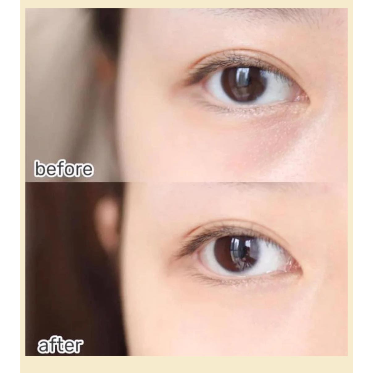 Kem Dưỡng Chống Lão Hóa, Cải Thiện Nếp Nhăn Mắt Sur.Medic Perfection 100 All In One Facial Eye Cream 35ml