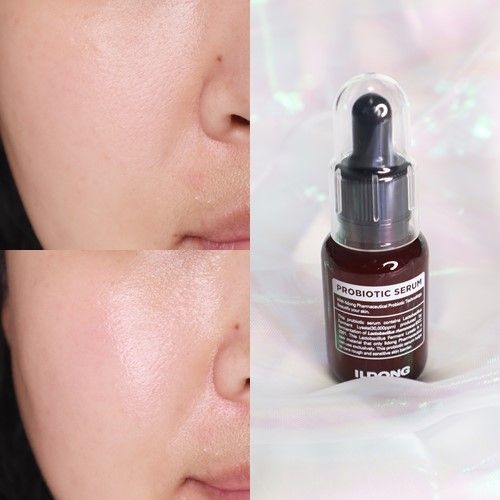 Tinh chất chống lão hóa, dưỡng trắng Ildong Probiotic Serum