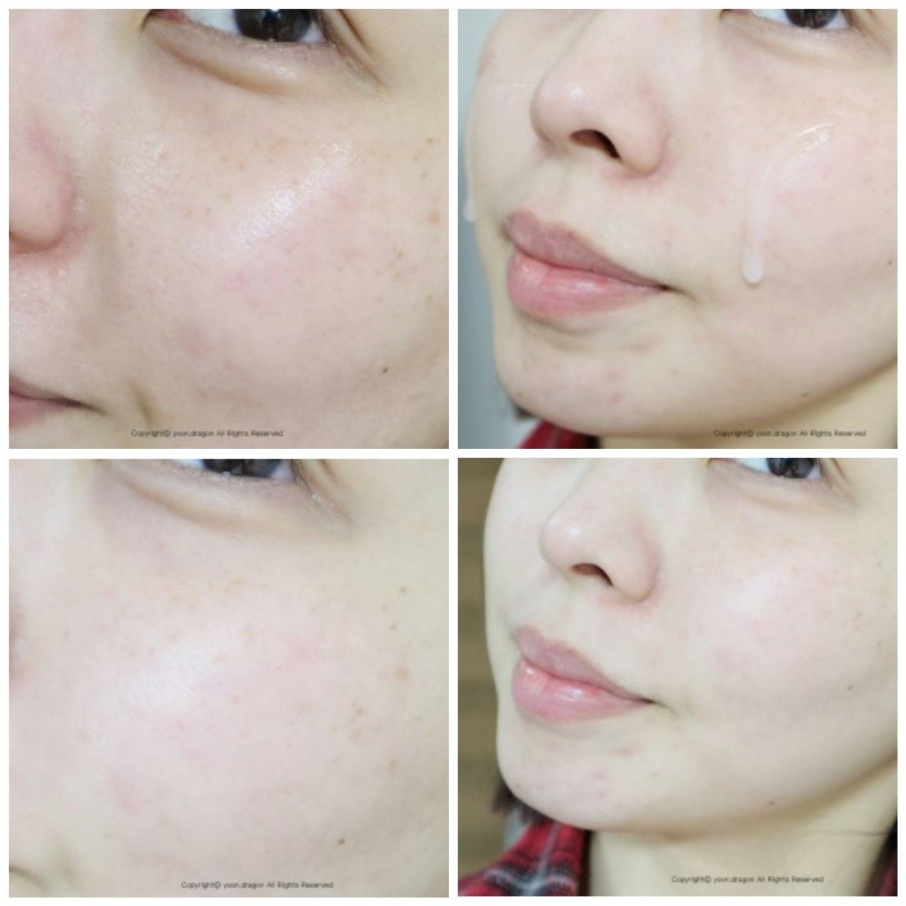 Tinh chất chống lão hóa, dưỡng trắng Ildong Probiotic Serum