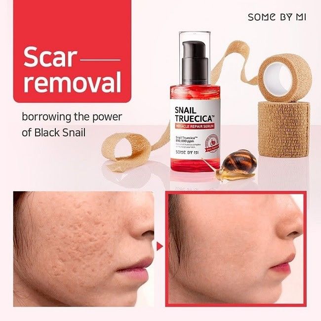 Bộ chăm sóc da làm mờ sẹo rỗ Some By Mi Snail Truecica Miracle Repair Starter Kit (4 Items)