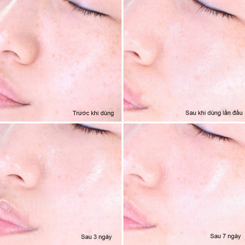 Bộ chăm sóc da làm mờ sẹo rỗ Some By Mi Snail Truecica Miracle Repair Starter Kit (4 Items)