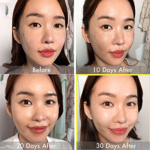 Bộ Kit trị mụn 30 ngày SOME BY MI AHA - BHA - PHA 30 DAYS MIRACLE AC SOS KIT (4 món) (không tích điểm)