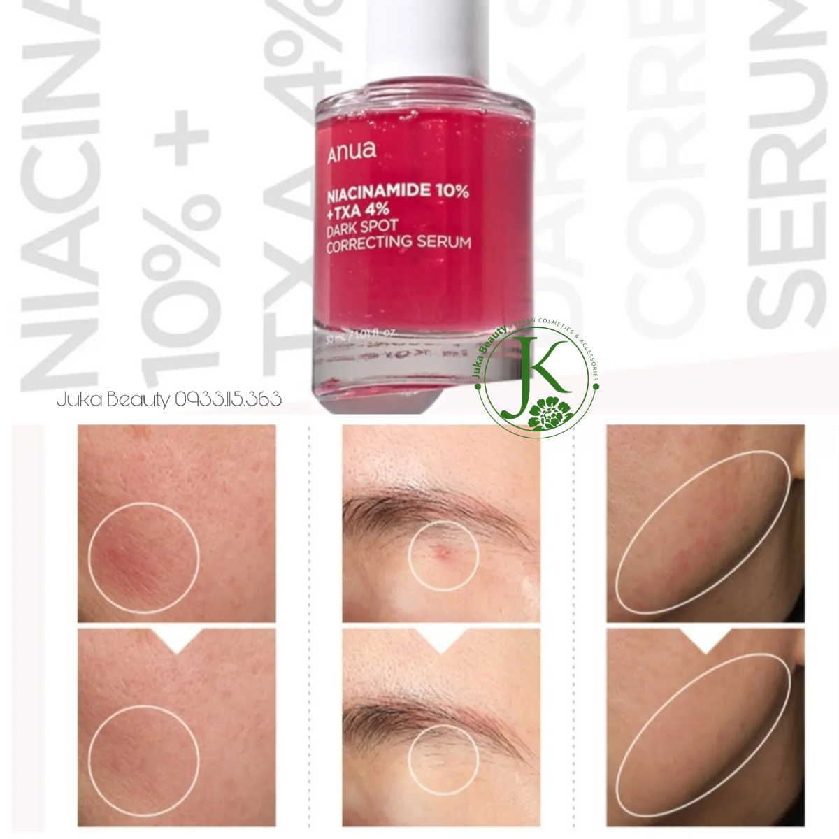 Tinh Chất Dưỡng Trắng, Mờ Thâm Anua Niacinamide 10% + TXA 4% Serum 30ml