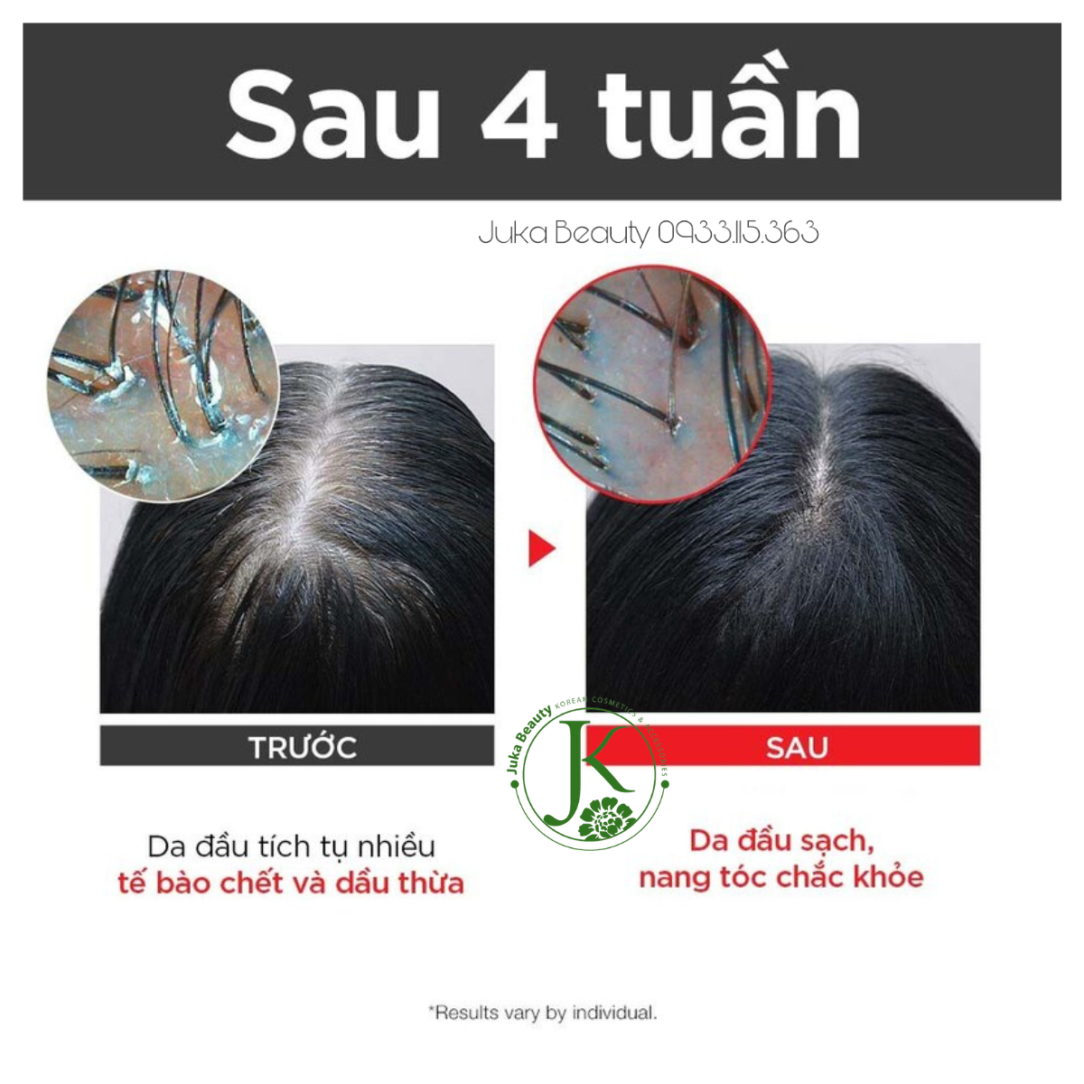 Xịt Hỗ Trợ Mọc Tóc, Dưỡng Tóc Mềm Mượt DR.FORHAIR Folligen Tonic Original 120ml