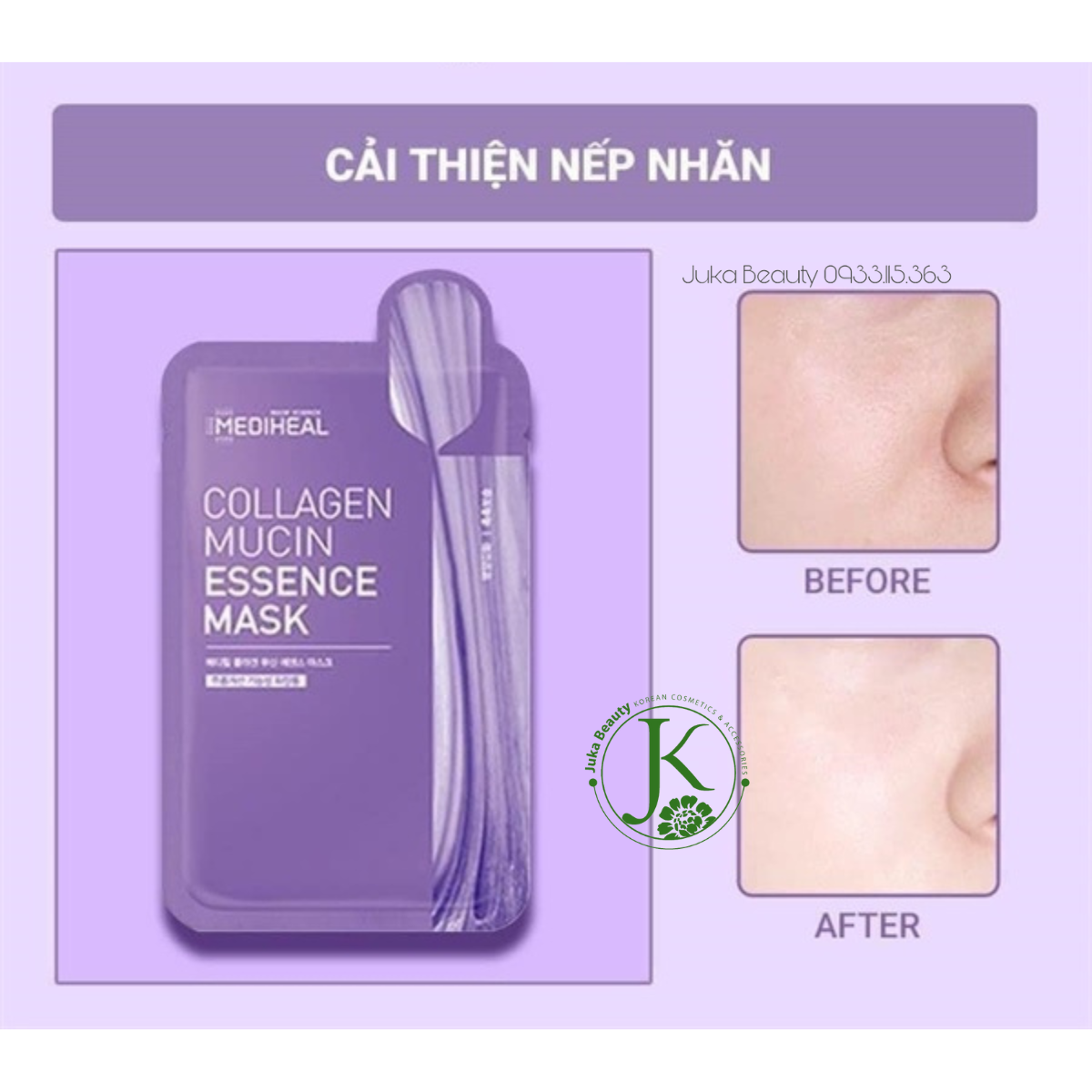Mặt Nạ Dưỡng Ẩm Sâu, Chống Lão Hóa Mediheal Essence Mask 20ml (1 miếng)
