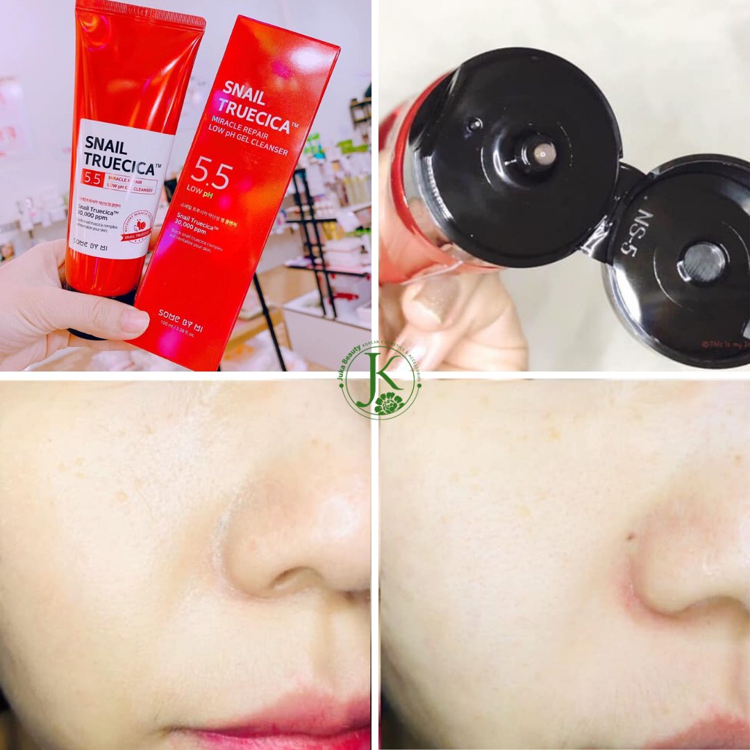 Bộ chăm sóc da làm mờ sẹo rỗ Some By Mi Snail Truecica Miracle Repair Starter Kit (4 Items)