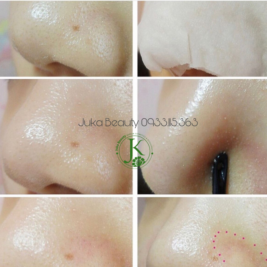 Mặt Nạ Lột Mụn Đầu Đen Ciracle Goodbye Blackhead Off Cotton Mask (20 miếng)