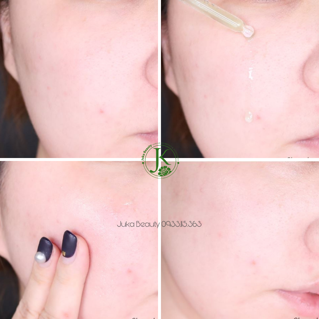 (Mẫu mới) Tinh chất giảm mụn, làm dịu da Some By Mi AHA BHA PHA 30 Days Miracle Serum 50ml