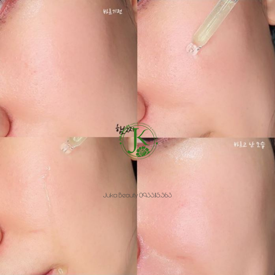 (Mẫu mới) Tinh chất giảm mụn, làm dịu da Some By Mi AHA BHA PHA 30 Days Miracle Serum 50ml