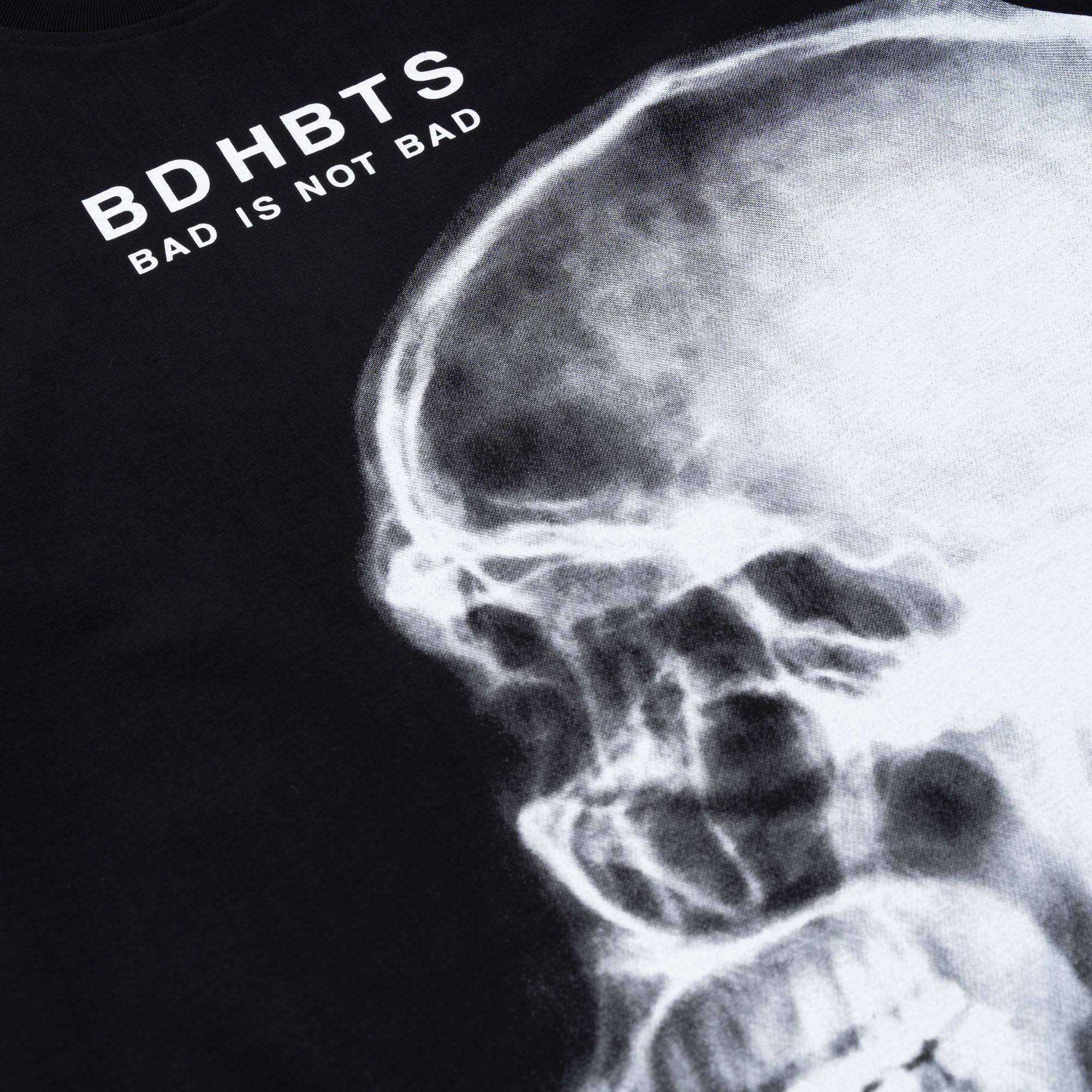 X-RAY
