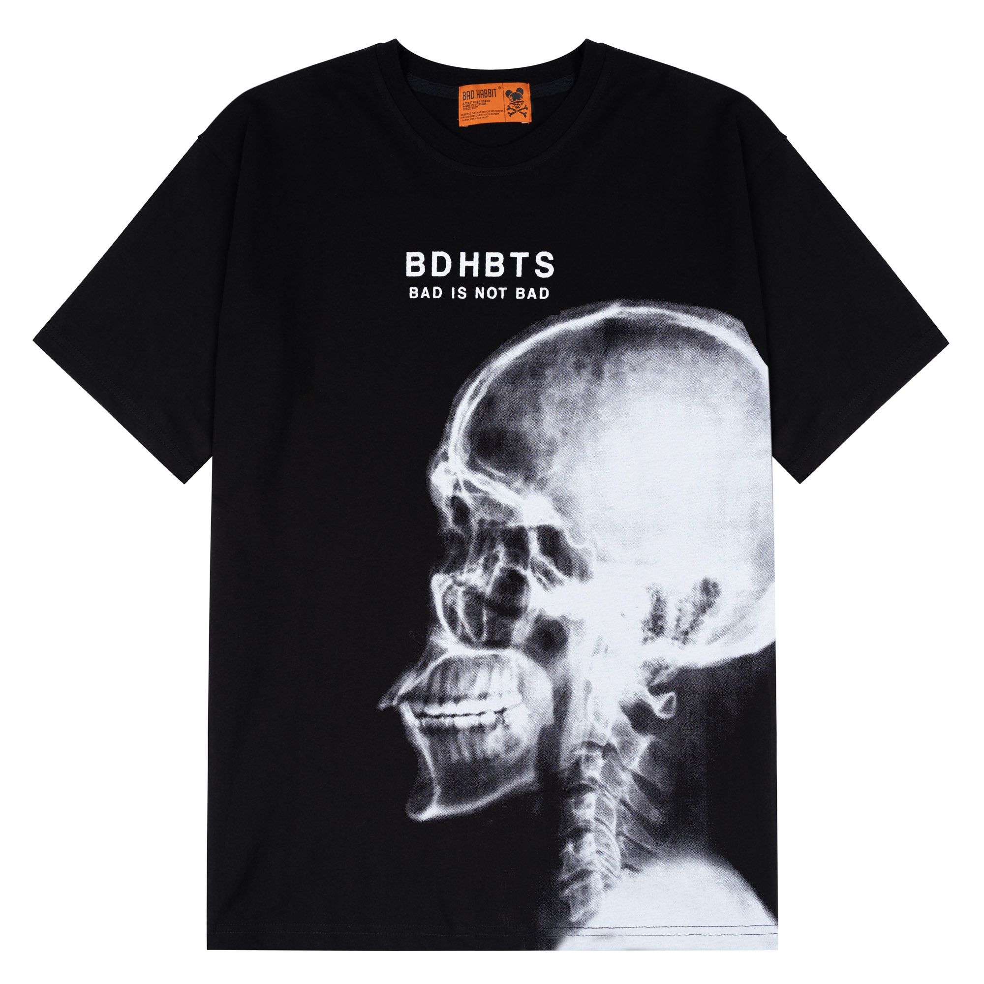 X-RAY