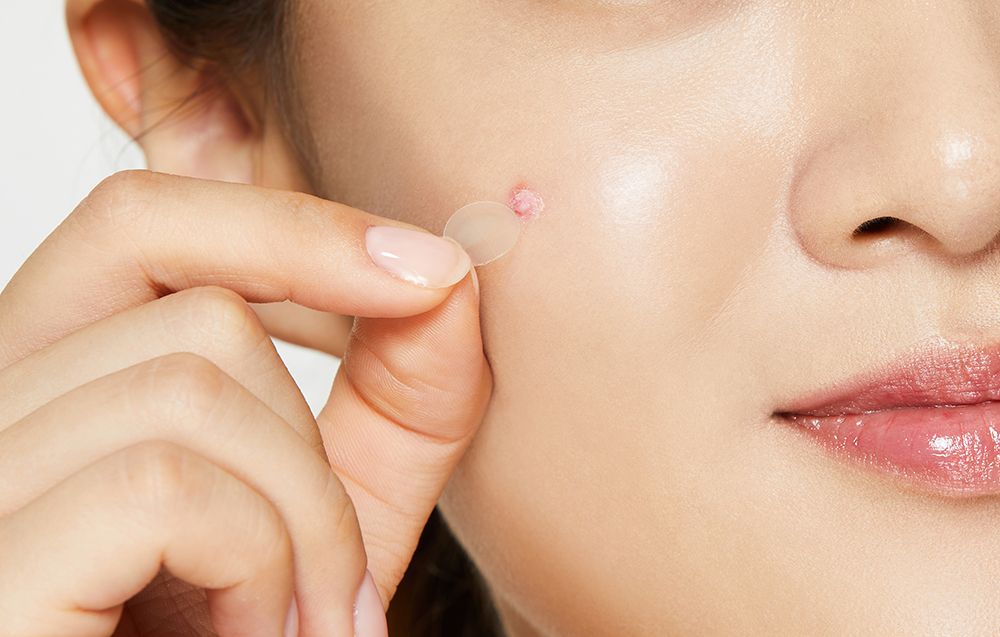 Miếng dán mụn - COSRX Clear Fit Master Patch
