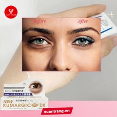 Kumargic_Kem Dưỡng Mắt Giảm Quầng Thâm & Bọng Mắt (Mới) 20g