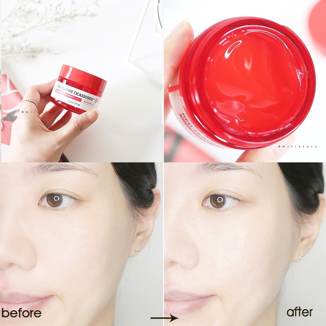 Kem Dưỡng Giảm Mụn Some By Mi Red Teatree Cicassoside Final Solution Cream