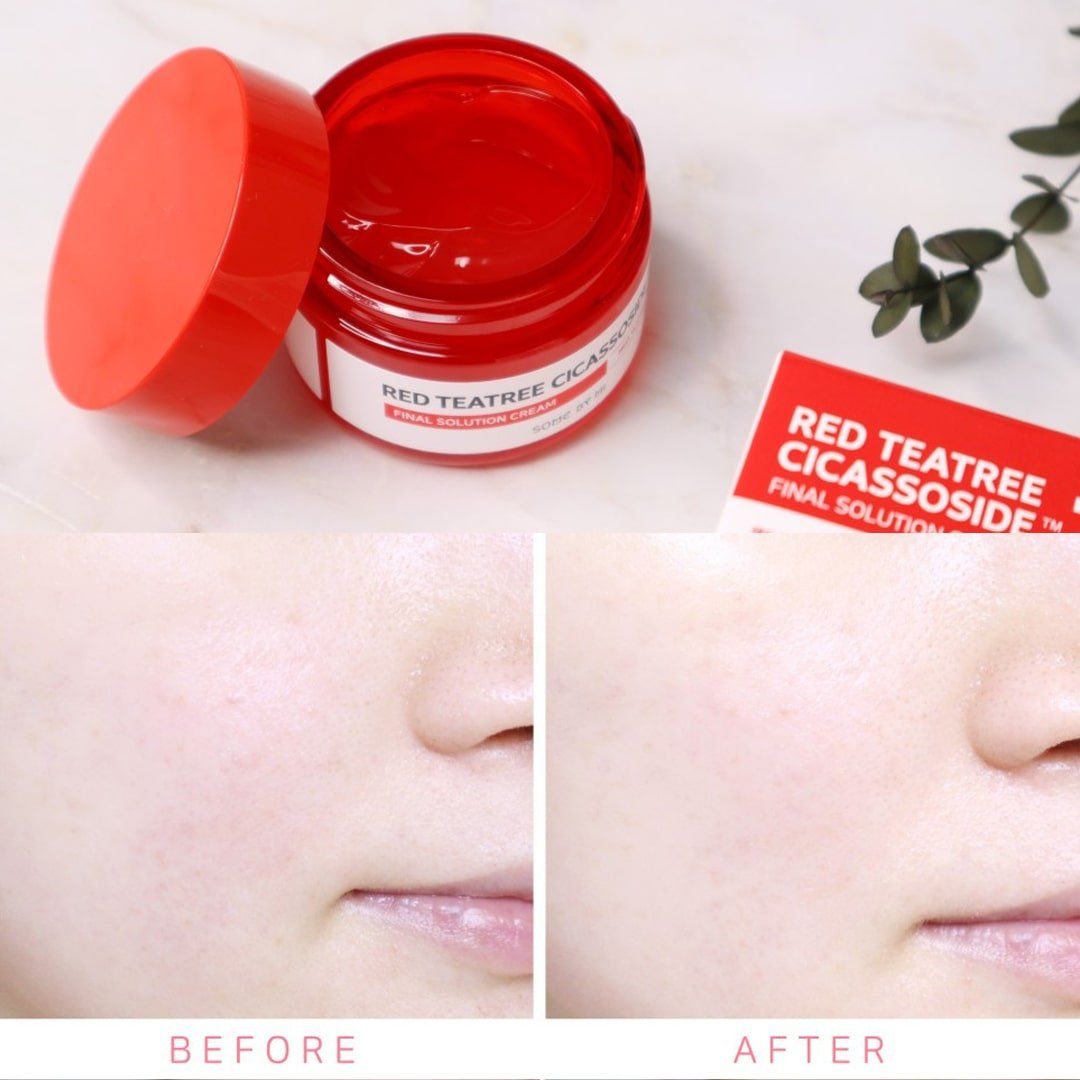  Kem Dưỡng Giảm Mụn Some By Mi Red Teatree Cicassoside Final Solution Cream 