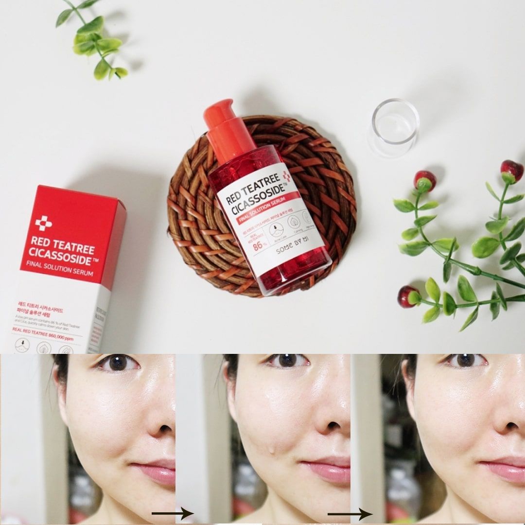 Tinh chất Tràm Trà Đỏ Some By Mi Red Teatree Cicassoside Final Solution Serum 50ml