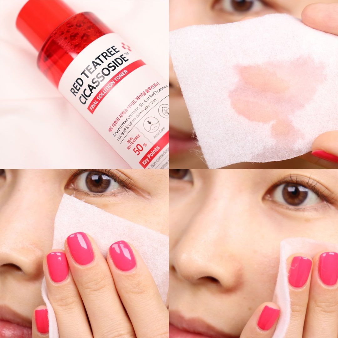 Nước Hoa Hồng Giảm Mụn Some By Mi Red Teatree Cicassoside Final Solution Toner