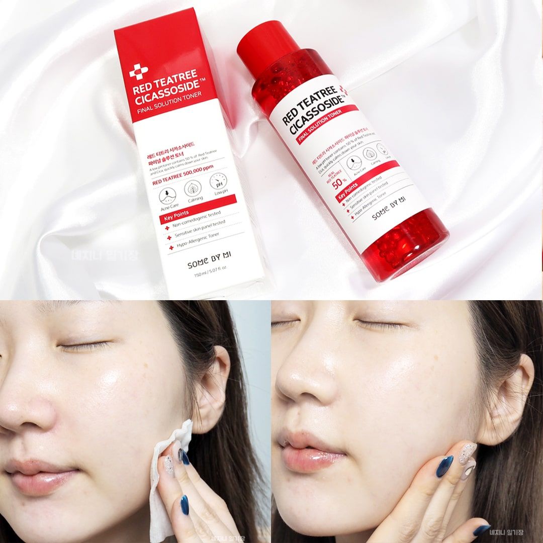 Nước Hoa Hồng Giảm Mụn Some By Mi Red Teatree Cicassoside Final Solution Toner