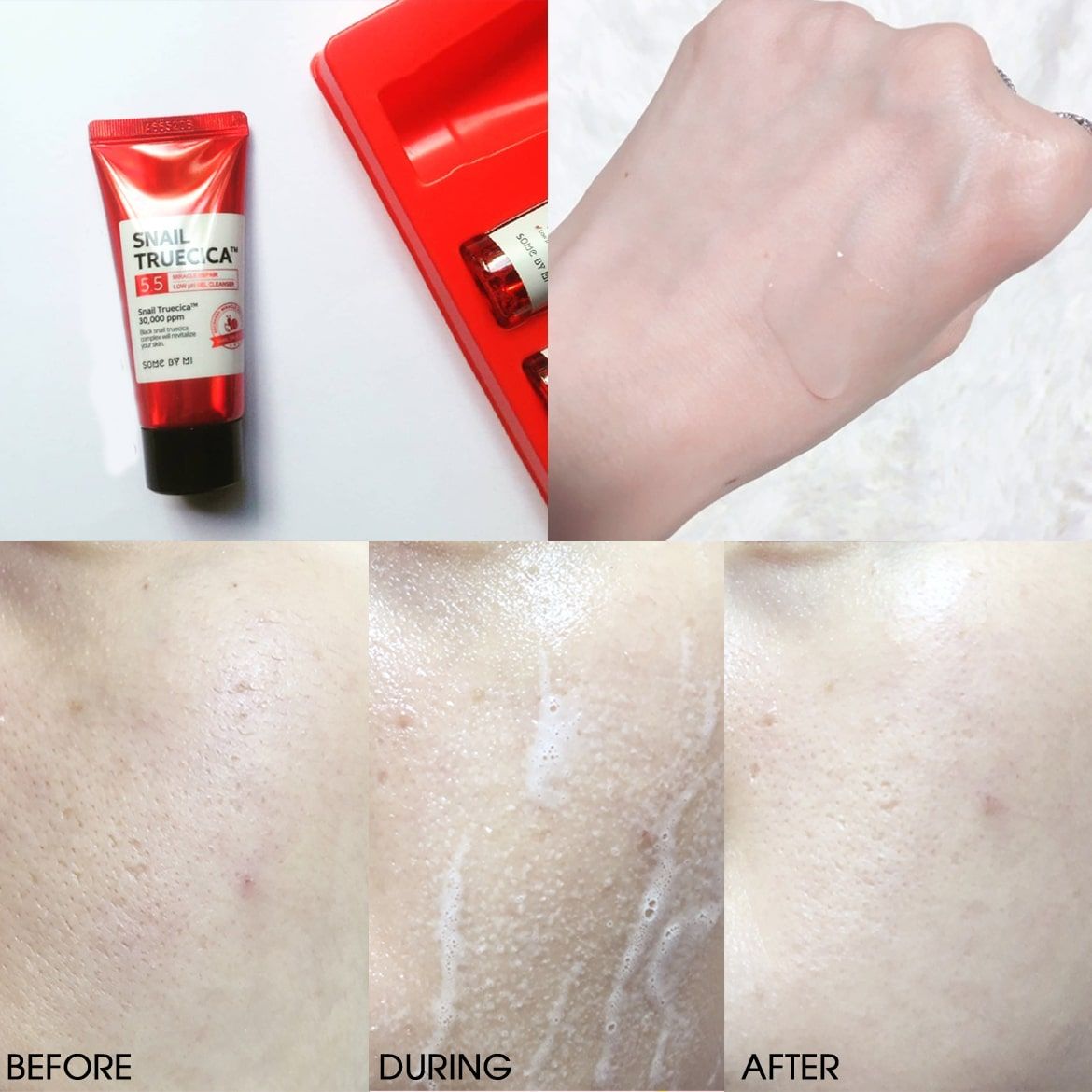 Set Phục Hồi Da Some By Mi Snail Truecica Miracle Repair Starter Kit 4 Món