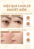  Bảng Che Khuyết Điểm 5 trong 1 FOCALLURE All In One Concealer Palette 01 | FA299 