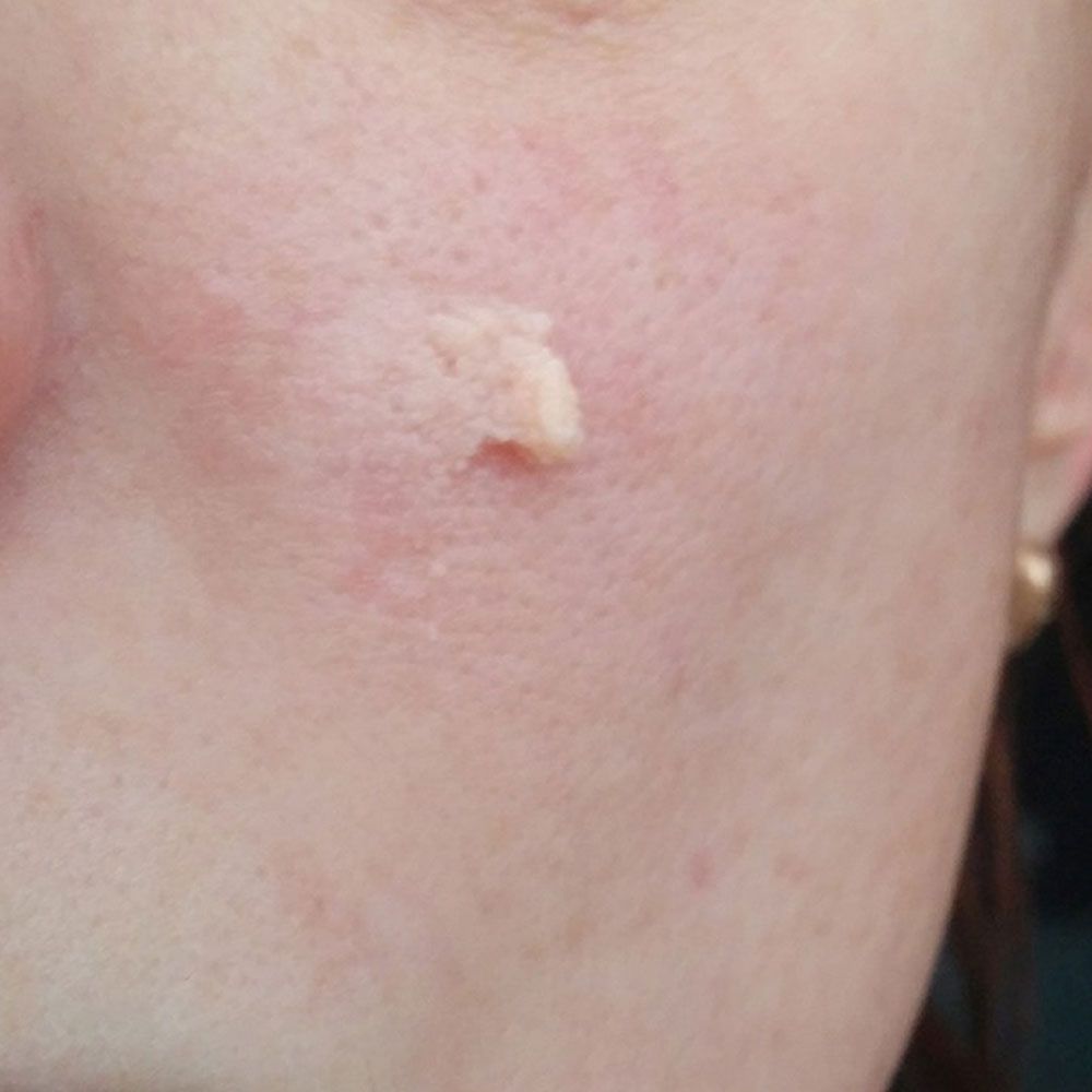 Kem Lót NYX Pore Filler POF01