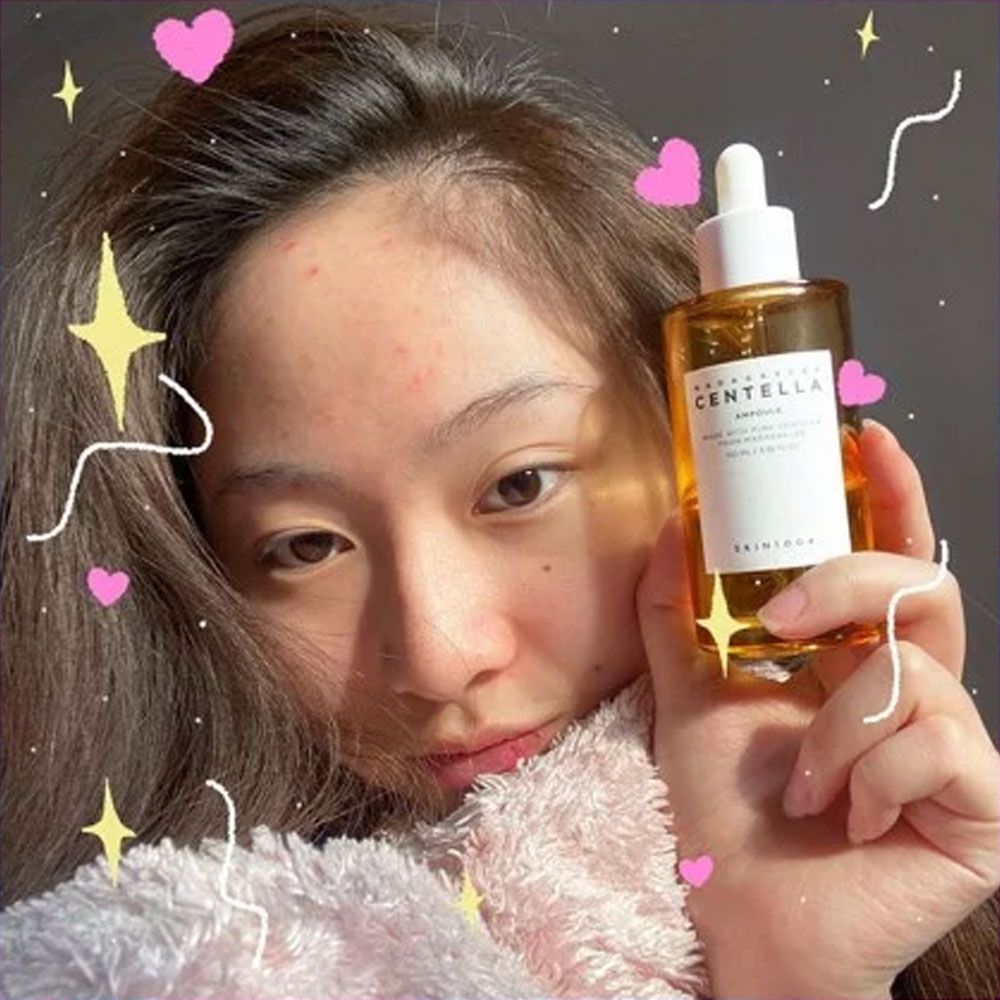 Tinh Chất Rau Má Skin1004 Madagascar Centella Asiatica Ampoule - 100ml