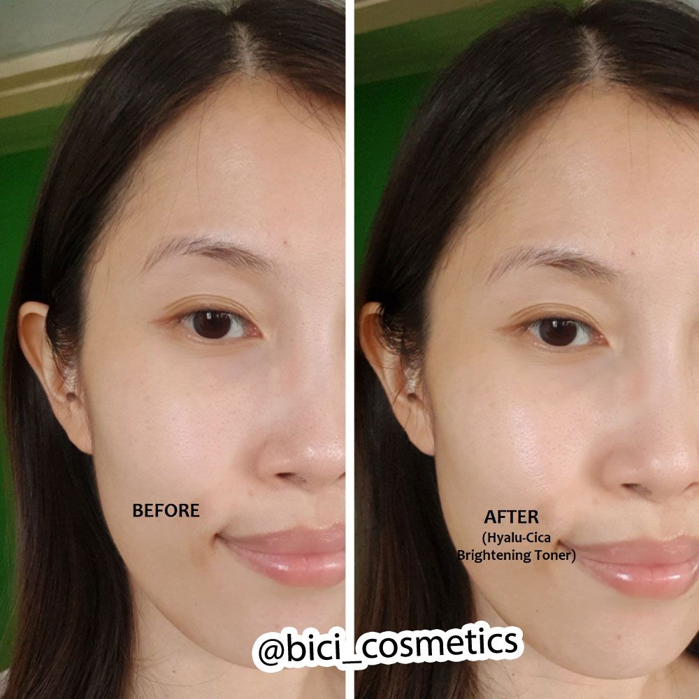 Nước Hoa Hồng Skin1004 Madagascar Centella Hyalu-Cica Brightening Toner