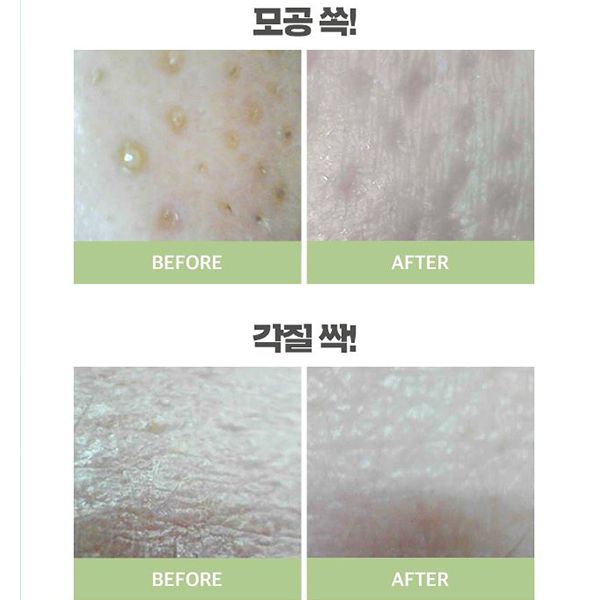 Mặt Nạ Đất Sét A’Pieu Phyton Cide