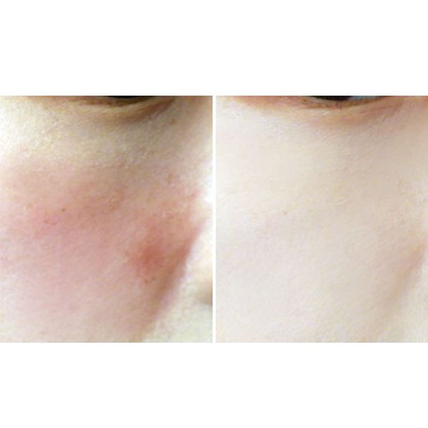 Combo Phấn Nén Carenel Motd Shine Pact Tặng 1 Son Kem Lì Carenel Ruby Airfit Velvet Tint (Màu Ngẫu Nhiên)