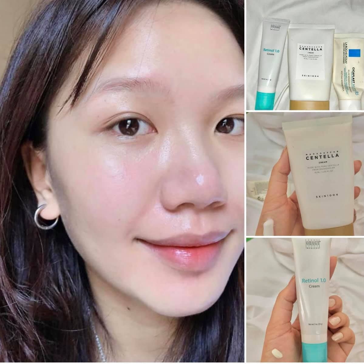  Kem Chống Lão Hóa & Trẻ Hóa Da OBAGI MEDICAL 360 Retinol 1.0 Cream 28g 